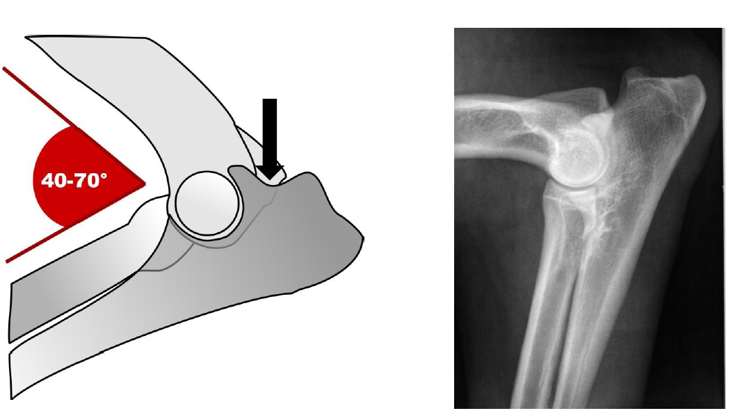 Roentgen Figur 1 - Optimal gebeugter Ellenbogen